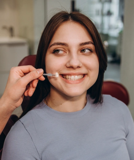No Prep Veneers
