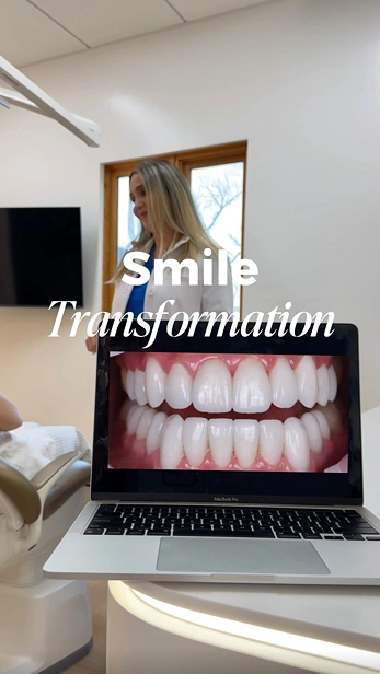 aptop displaying a before-and-after smile transformation in a dental office setting.