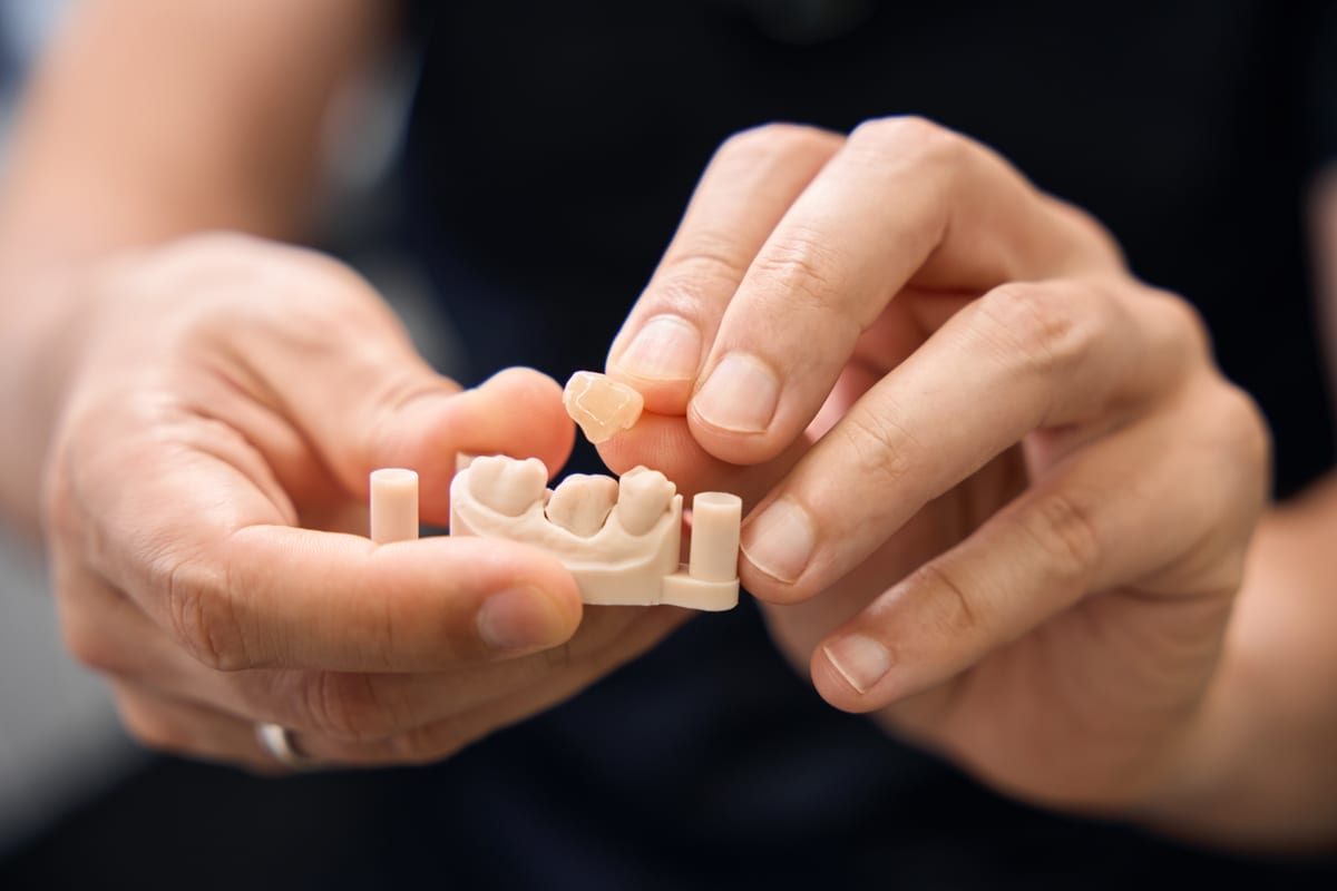 Dental Crowns in Beverly Hills