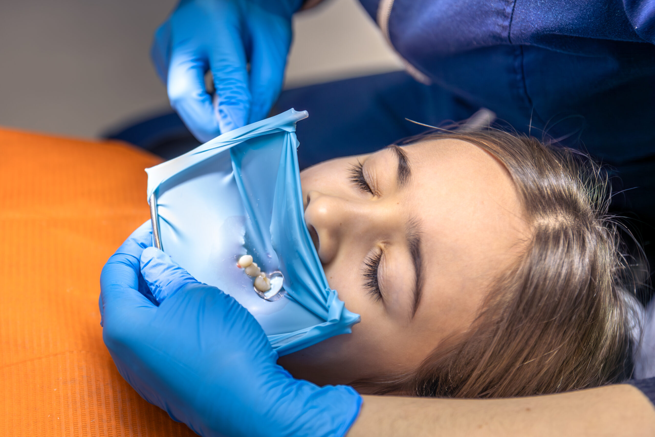 Dentist in blue gloves showing patient dental isolation materials during tooth restoration procedure.